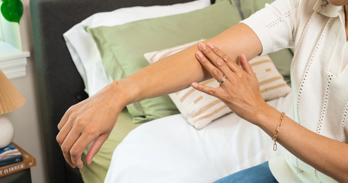 Featured image for Experts reveal top bug bite relief products of 2023.