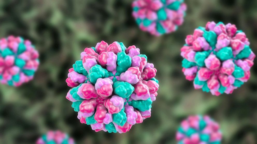 Featured image for "Food Handler's Illness Triggers Norovirus Outbreak Sickening Over 300"