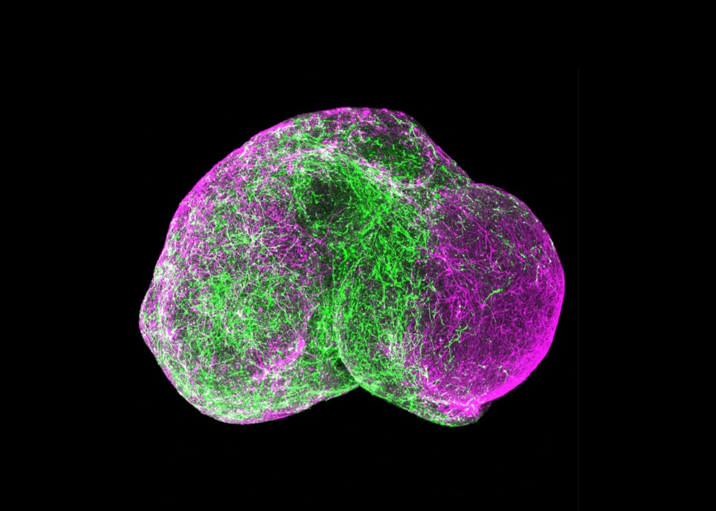 Featured image for Mini Brains Mimic Kindergarten Neural Wiring, Raising Ethical Questions