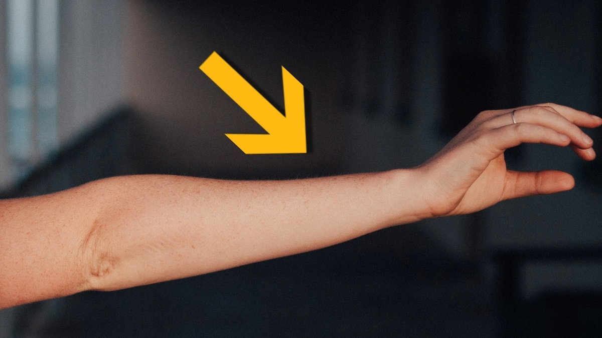 Featured image for Humans Evolving: Arms Developing Extra Arteries