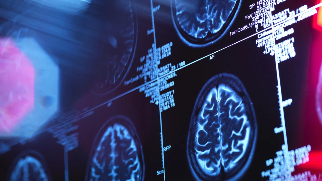 Featured image for Seattle AI Startup Develops Tool to Combat Cognitive Decline