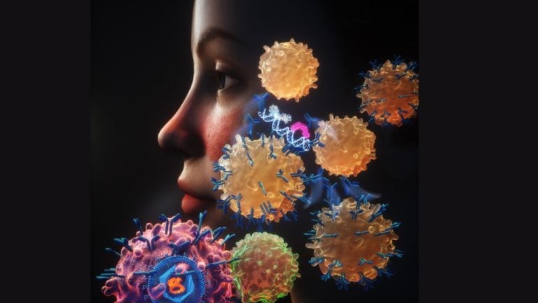 Featured image for Scientists Link Epstein-Barr Virus to Lupus Development