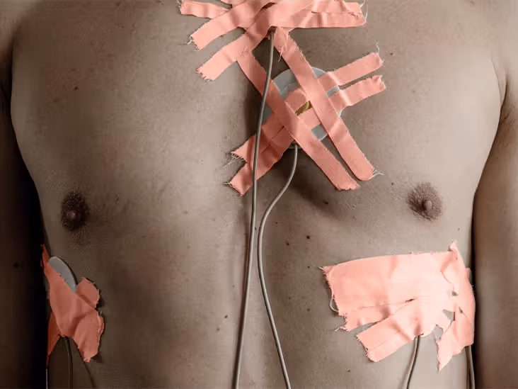 Featured image for "Genetic Insights into Heart Disease Risk and Prevention"