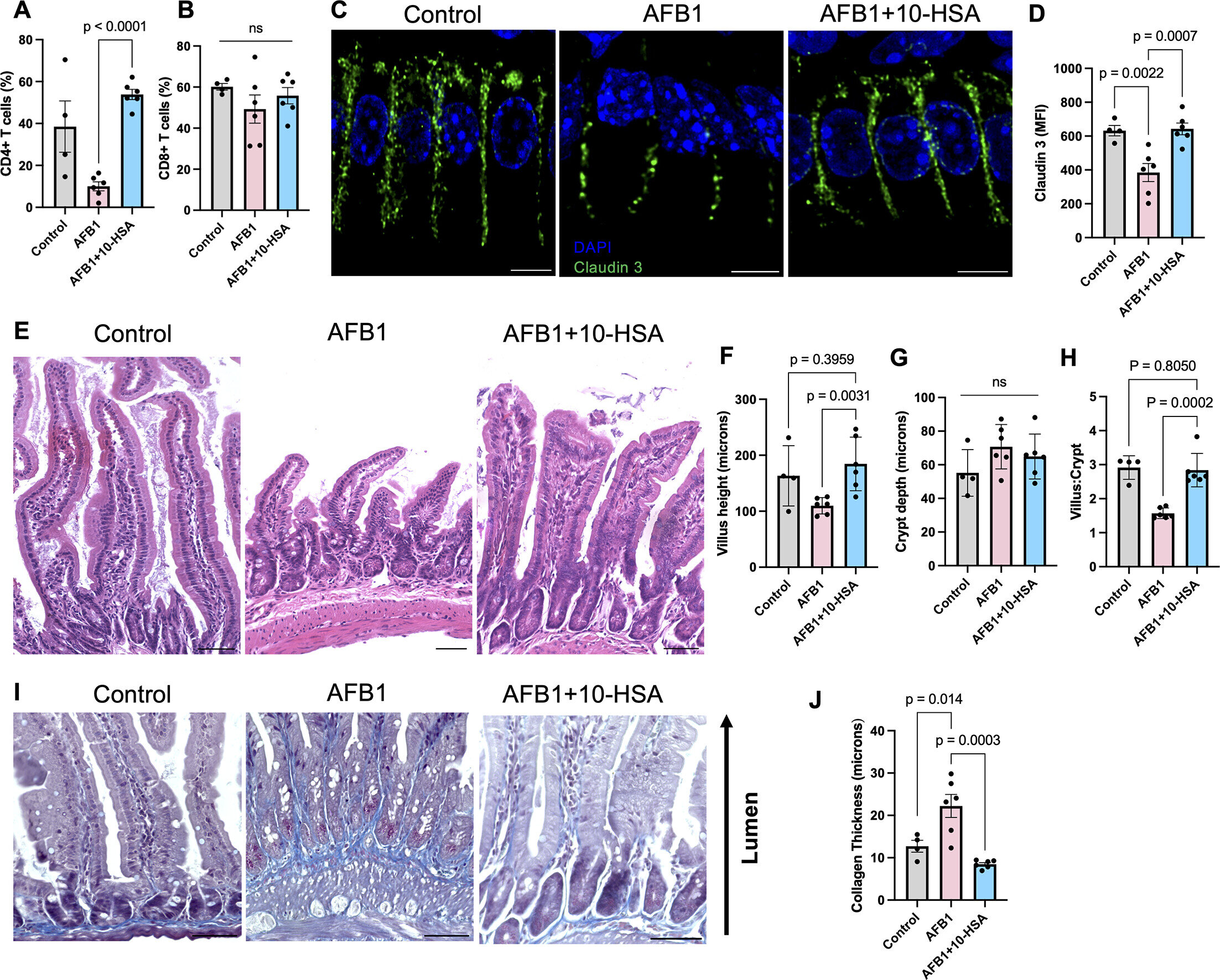 Featured image for Gut Bacteria Molecule Shows Promise in Reversing Liver Damage