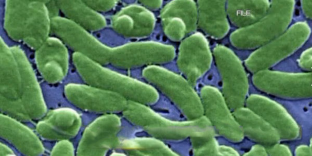 Featured image for Four Florida Deaths in 2025 Linked to Flesh-Eating Vibrio Bacteria