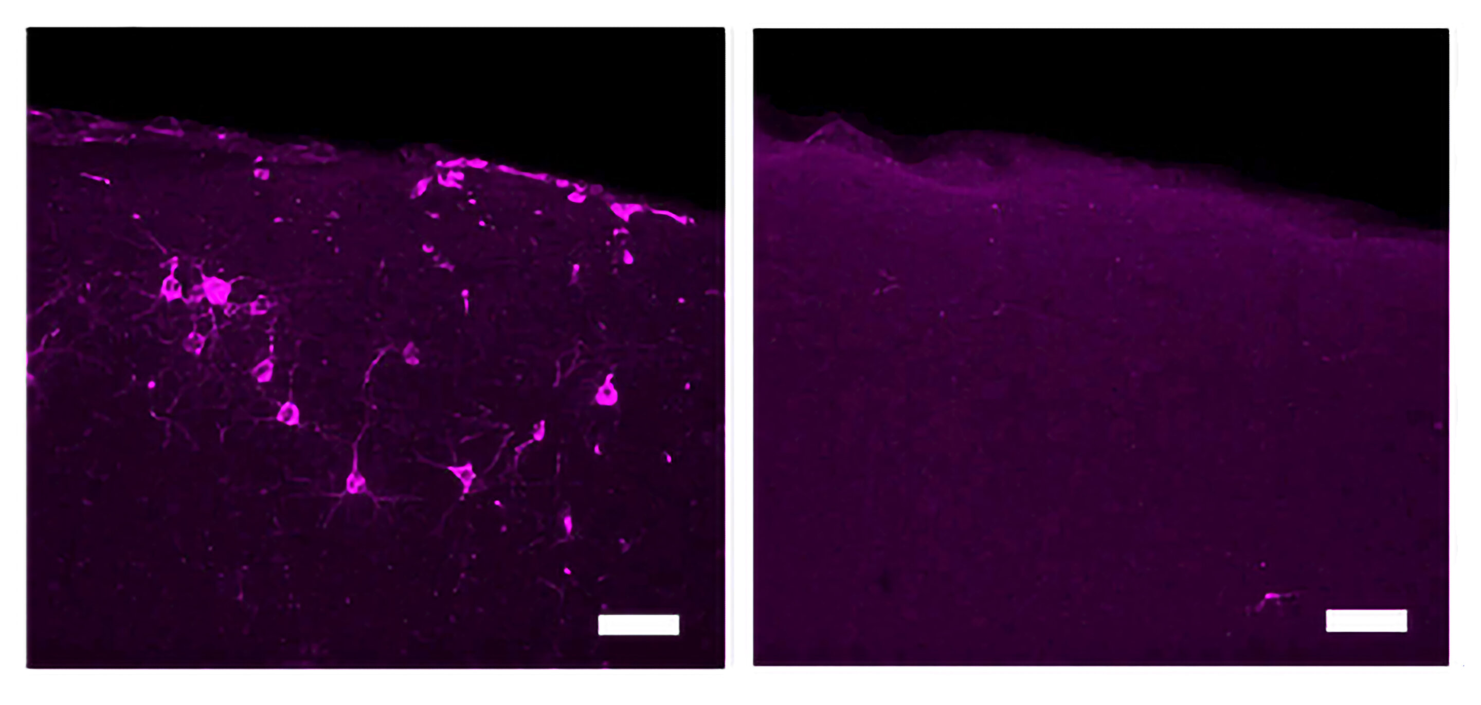 Featured image for Tactile Stimulation at 40 Hz Reduces Alzheimer's Pathology and Symptoms.