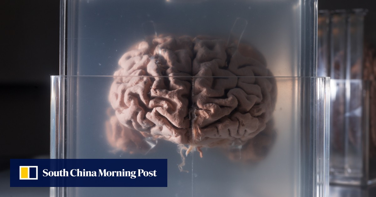 Featured image for Scientists Aim to Unlock Einstein's Brain with China's New Tech