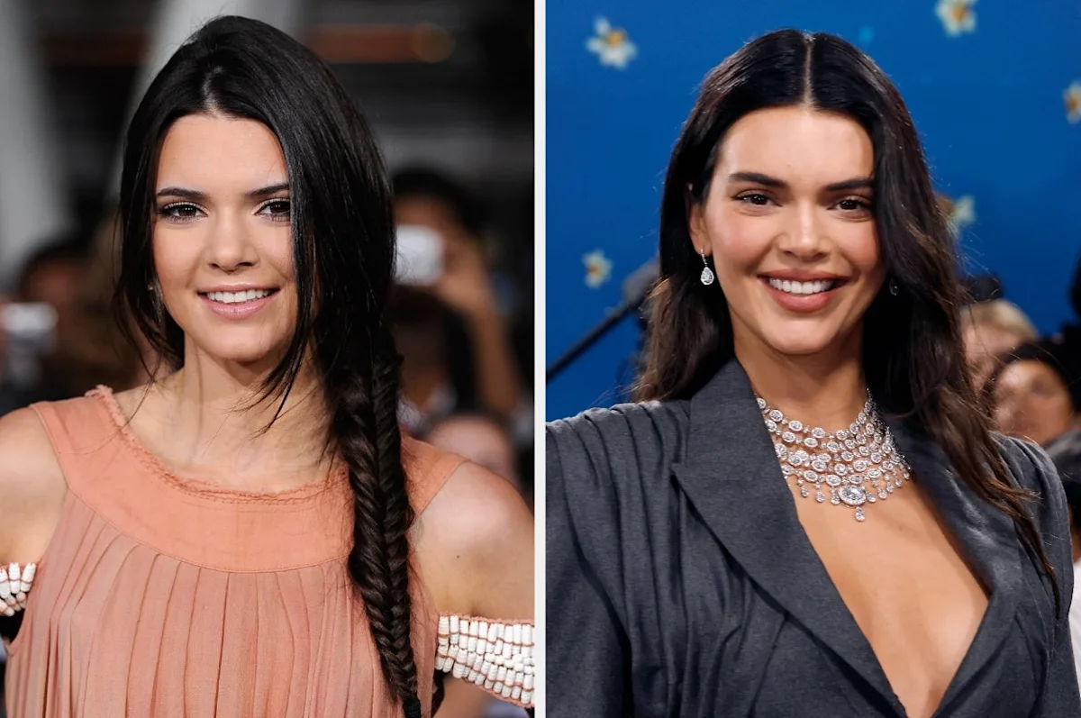 Featured image for Kendall Jenner Addresses Plastic Surgery Rumors and Reveals Her Cosmetic Procedures