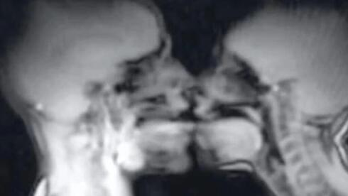 Featured image for Couple's MRI experiment offers new insights into the human body and sexuality