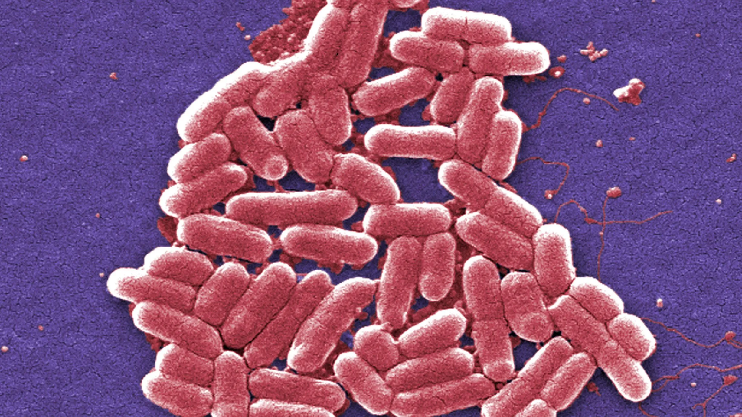 Featured image for WHO Warns of Global Surge in Drug-Resistant Superbugs