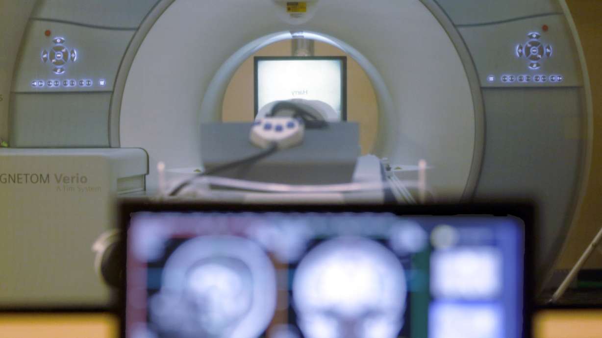 Man Dies After Metal Chain Accident in MRI Machine