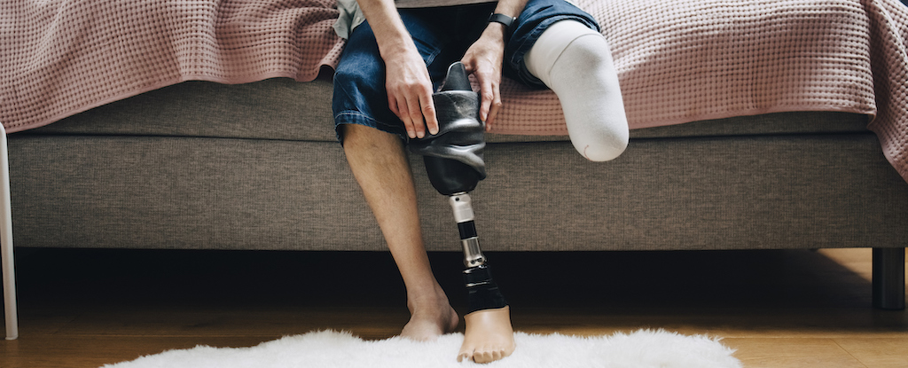 Featured image for New Study Challenges Long-Held Beliefs About Phantom Limbs and Brain Maps