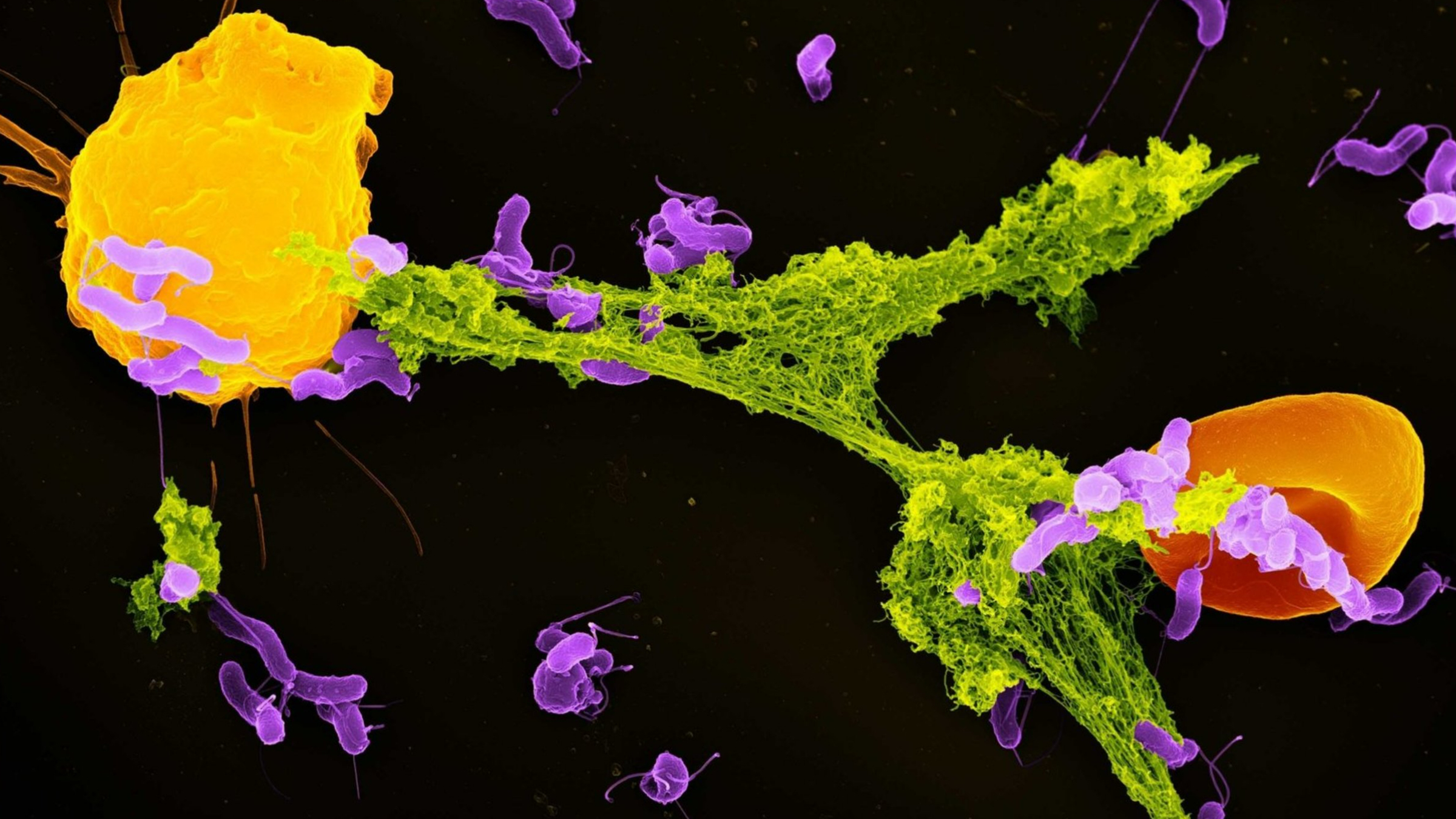 Featured image for Breaking Up Immune Webs Could Lead to New Autoimmune Treatments