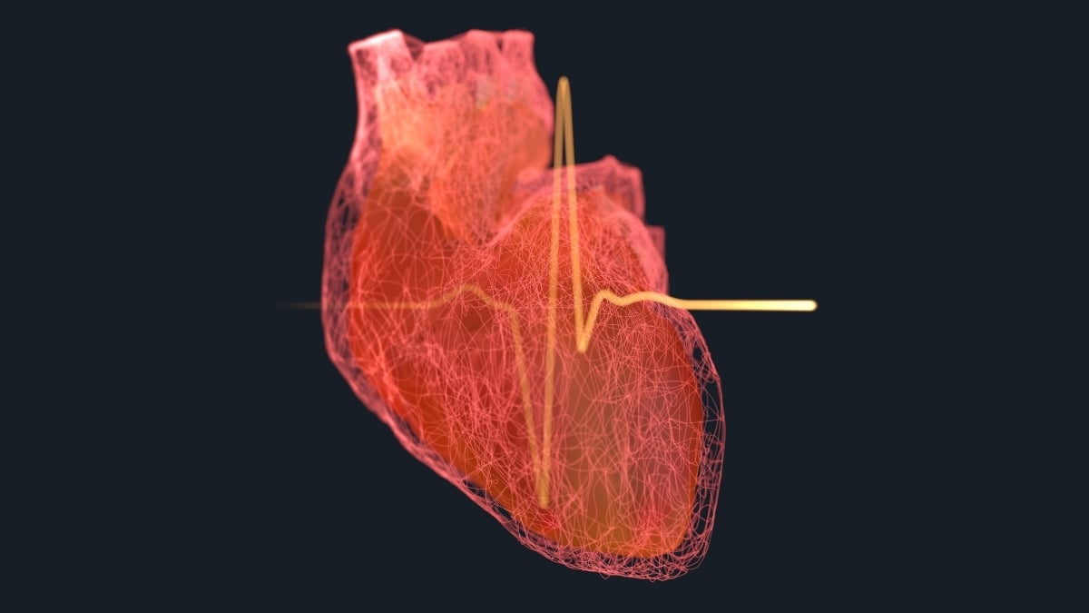 Featured image for Major Study Finds 4 Key Factors Behind 99% of Heart Attacks and Strokes