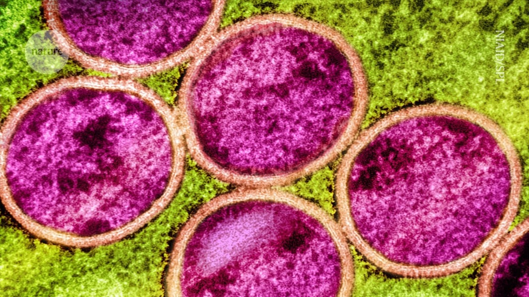 Featured image for Research Reveals Mpox's Curious Evolution and Global Resurgence Risks