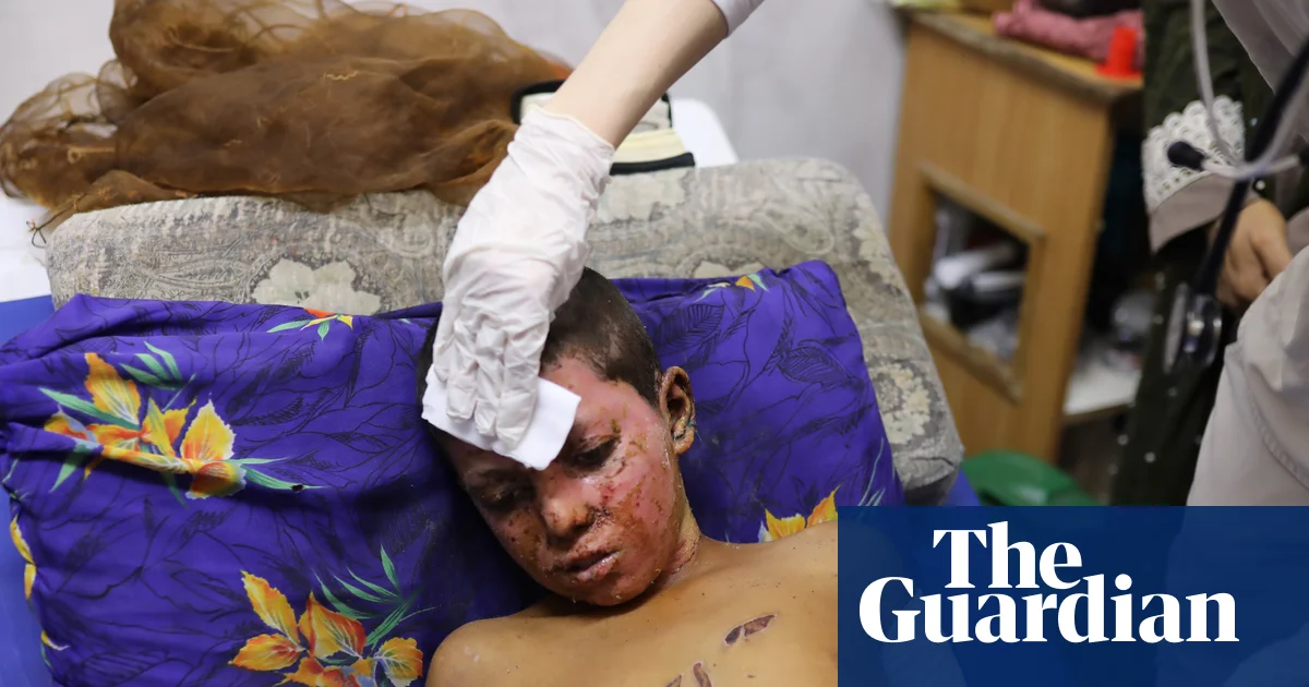 Featured image for Gaza Civilian Injuries Mirror Battlefield Wounds, Study Finds