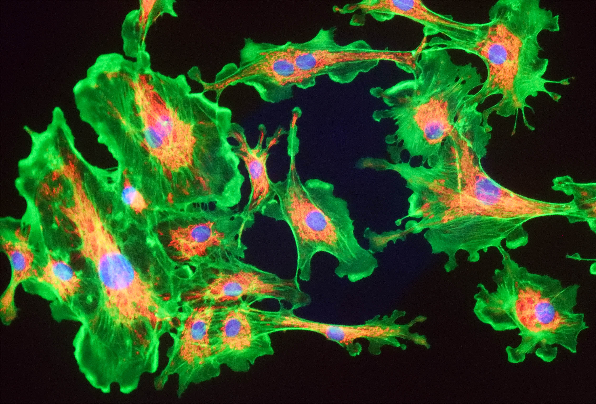 Featured image for Mitochondria Activation Reverses Memory Loss