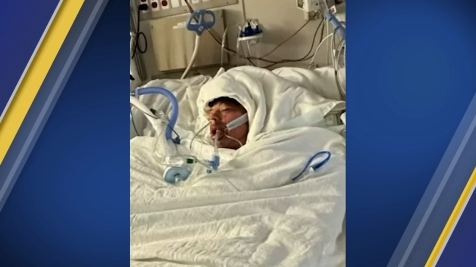 Featured image for TikTok challenge leaves teen with severe burns on 80% of body.