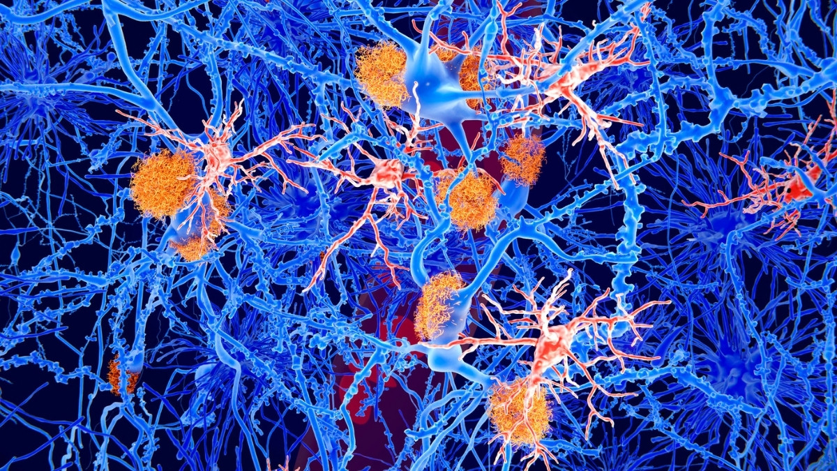 Featured image for Young Immune Cells Show Promise in Reversing Alzheimer's in Mice