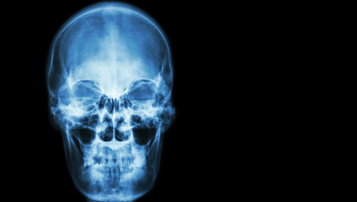 Featured image for Man Hospitalized After Covering Nose and Mouth While Sneezing