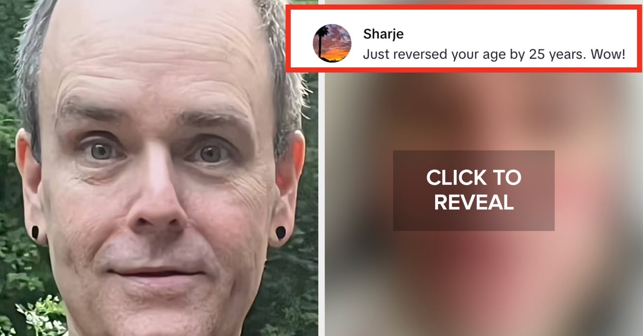 Featured image for Man's Mexico Facelift Stuns onlookers