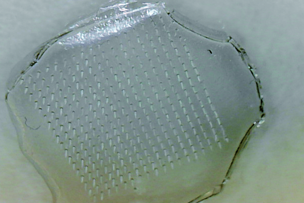 Featured image for Innovative Patch Offers Fight Against Food Poisoning