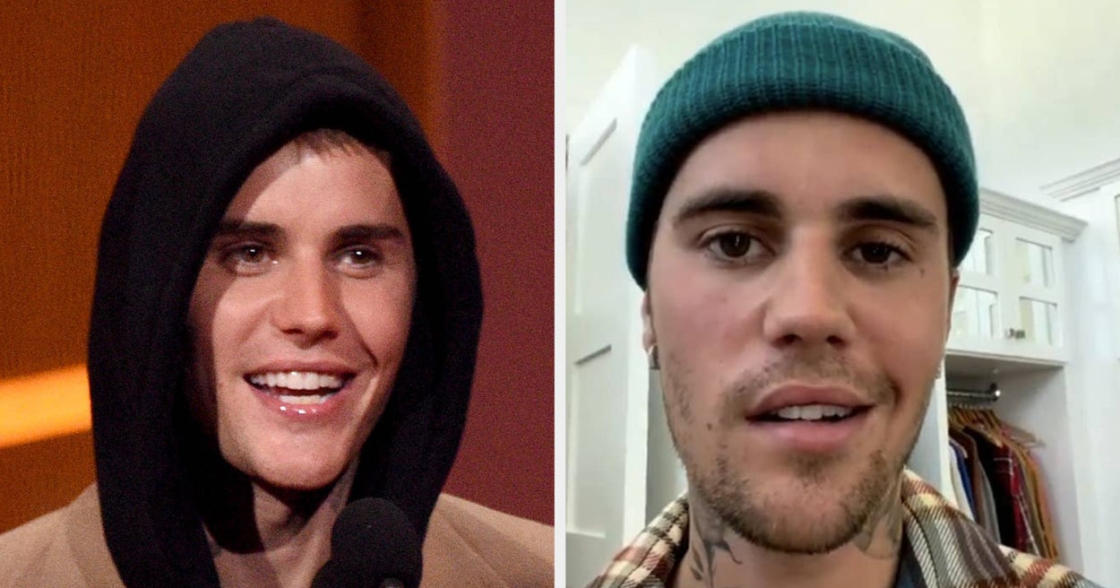 Featured image for Justin Bieber's Facial Paralysis Recovery Update