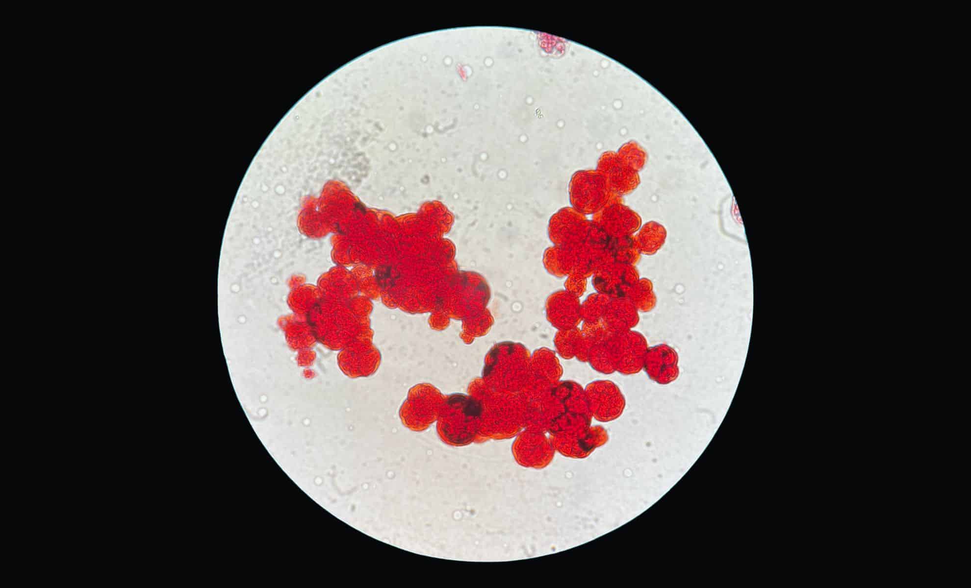 Featured image for Scientists Find Organism That Challenges Life's Fundamentals