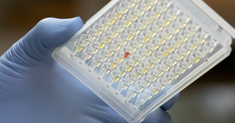 Featured image for New Insights into Long COVID: Prevalence, Symptoms, and Genetic Factors