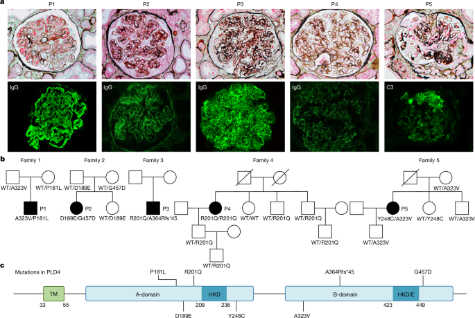 Featured image for PLD4 Mutations Linked to Systemic Lupus Erythematosus