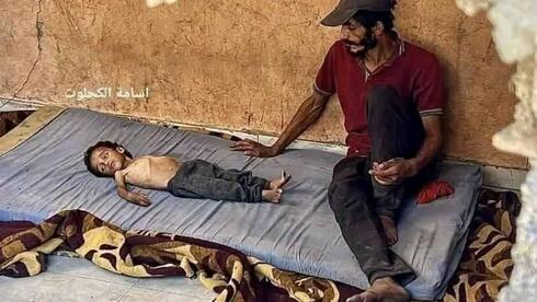 Featured image for Controversies and Corrections in Gaza Famine Coverage