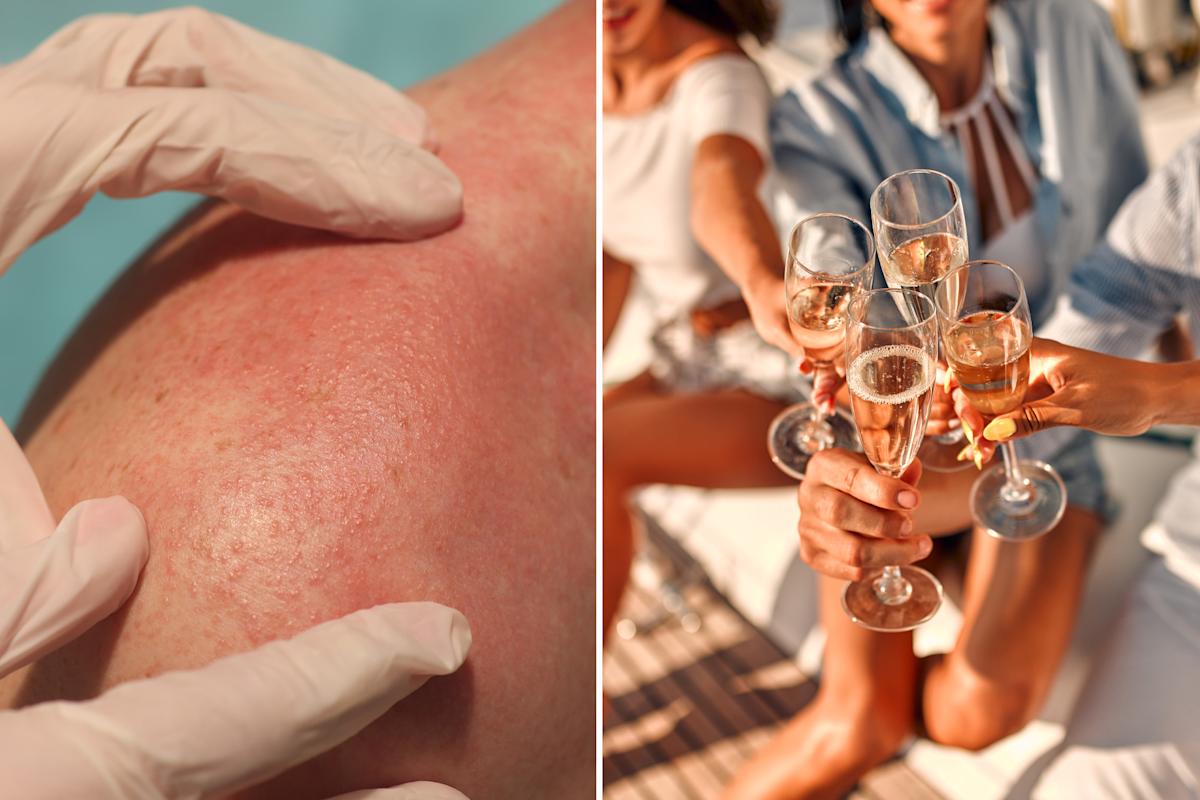 Featured image for Wealthy Regions See Rise in Unwanted Disease