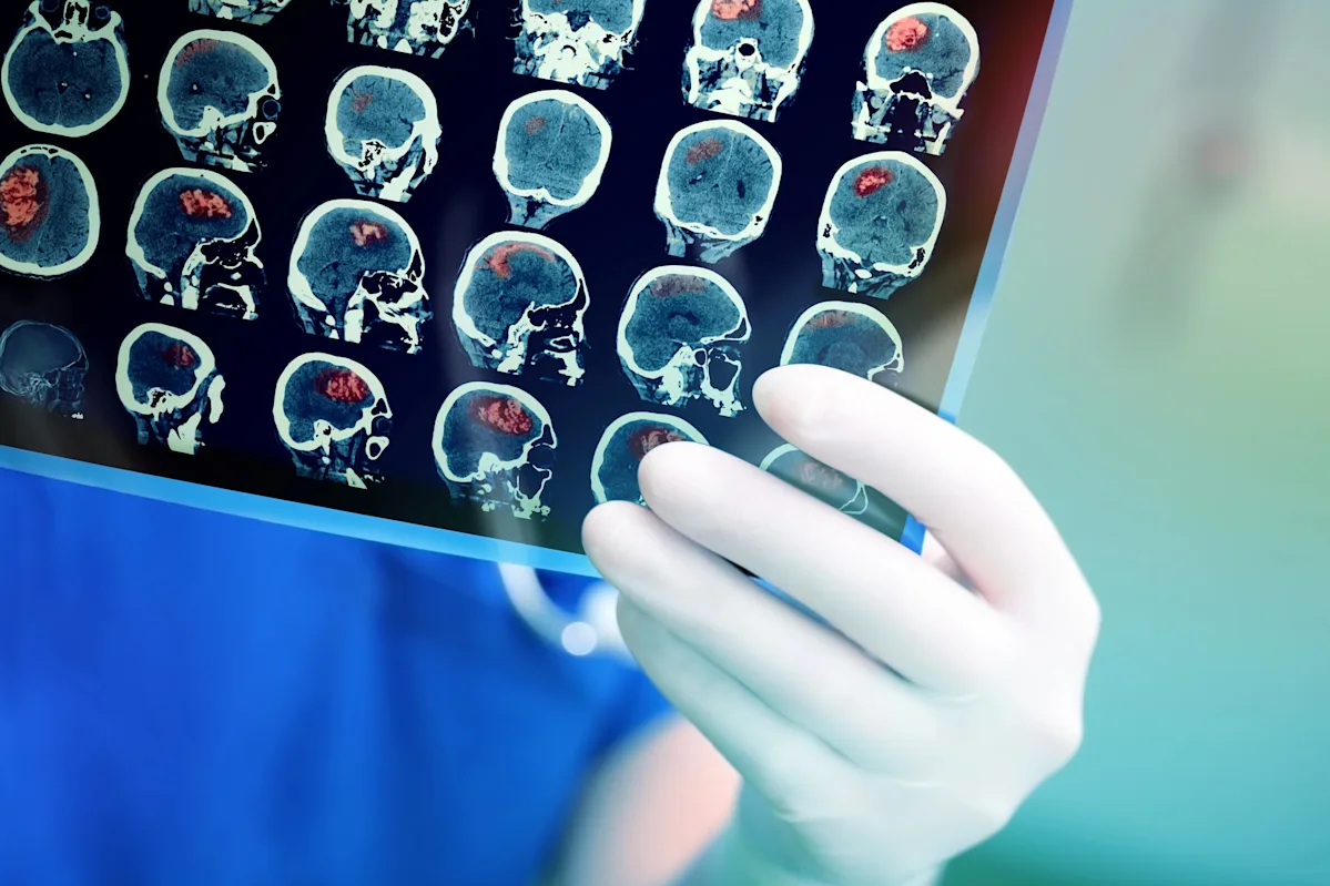 Featured image for Study Links Air Pollution to Increased Risk of Brain Tumors and Cognitive Issues