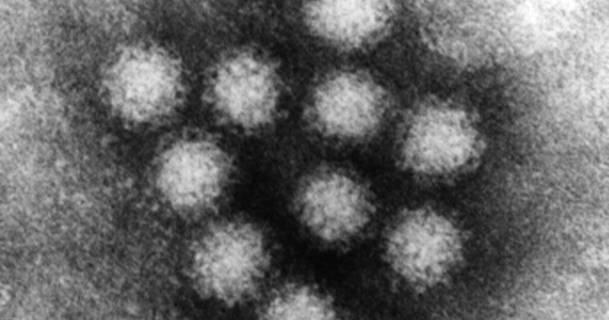 Featured image for Norovirus Outbreaks Detected in Northern California Counties.