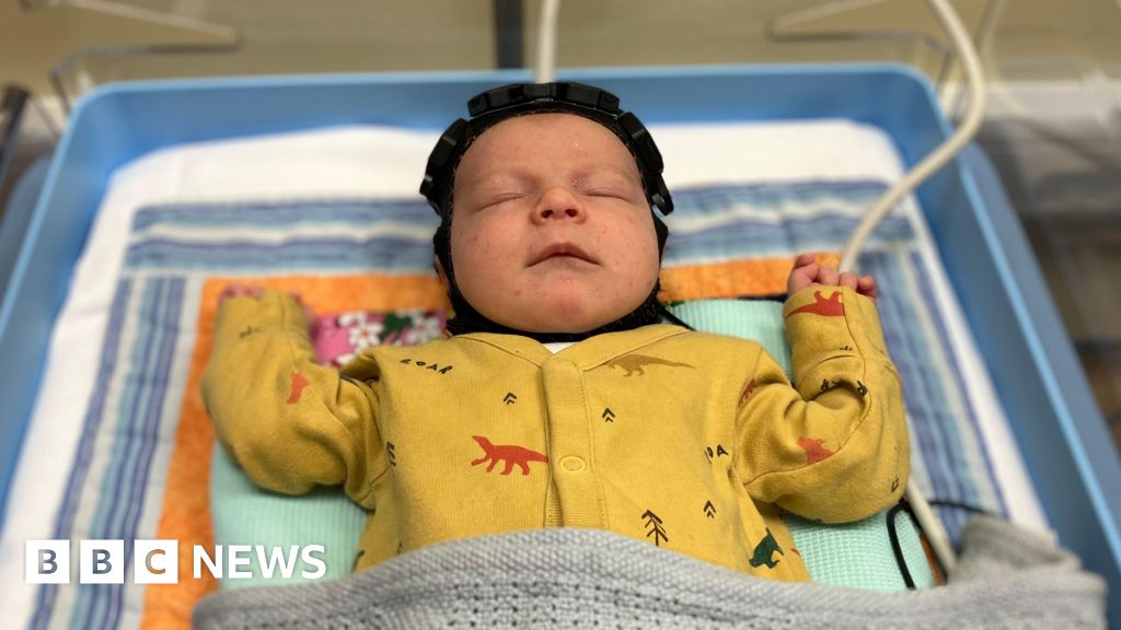 Featured image for Cambridge 'swimming cap' offers hope for brain-injured infants