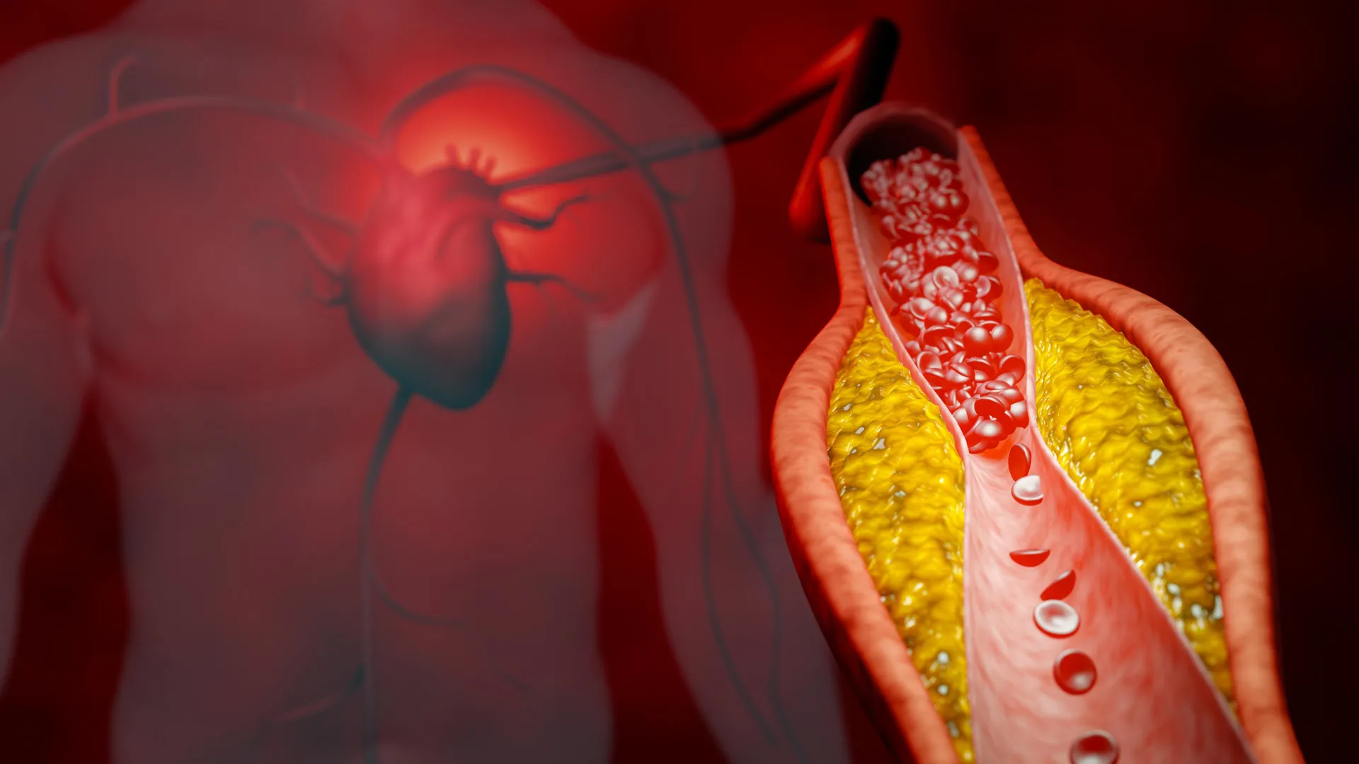 Featured image for Revolutionary Gene Therapy Halves Cholesterol Without Statins or Side Effects