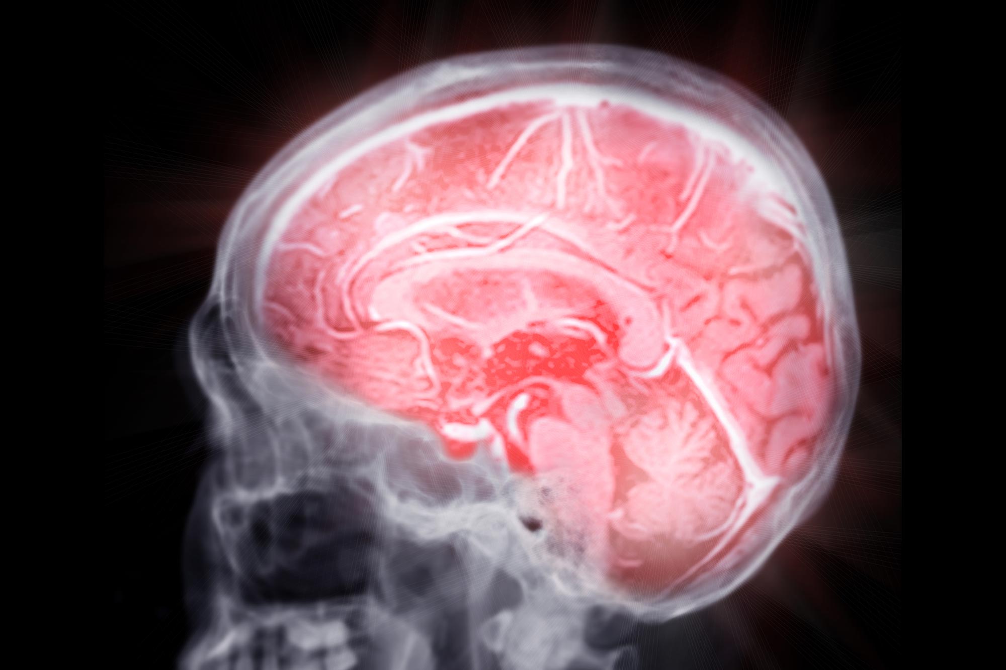 Featured image for Scientists Find Brain 'Switches' That Clear Alzheimer’s Plaques